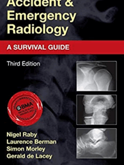 Accident and Emergency Radiology: A Survival Guide 3rd Edition, ISBN-13: 978-0702042324