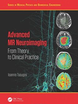 Advanced MR Neuroimaging: From Theory to Clinical Practice – Ioannis Tsougos