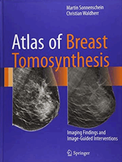 Atlas of Breast Tomosynthesis: Imaging Findings and Image-Guided Interventions, ISBN-13: 978-3319215655