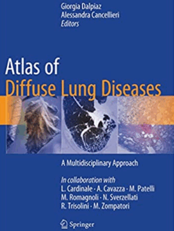 Atlas of Diffuse Lung Diseases: A Multidisciplinary Approach, ISBN-13: 978-3319427508