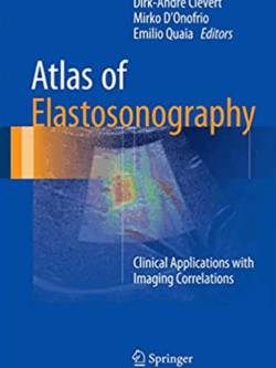 Atlas of Elastosonography: Clinical Applications with Imaging Correlations, ISBN-13: 978-3319441993