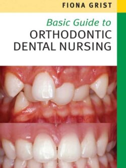 Basic Guide to Orthodontic Dental Nursing