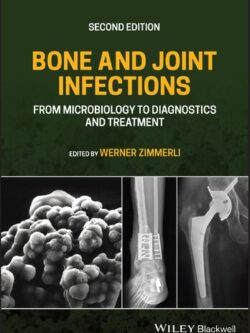 Bone and Joint Infections: From Microbiology to Diagnostics and Treatment (2nd Edition)