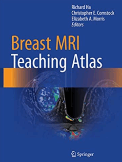Breast MRI Teaching Atlas 2017 Edition by Richard Ha, ISBN-13: 978-1493964079
