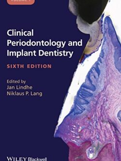 Clinical Periodontology and Implant Dentistry, 2 Volume Set (6th edition)