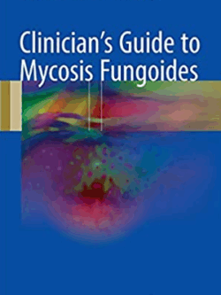 Clinician’s Guide to Mycosis Fungoides 2017 Edition, ISBN-13: 978-3319479064
