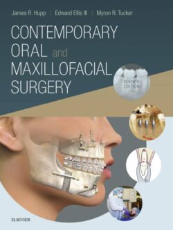 Contemporary Oral and Maxillofacial Surgery (7th Edition)