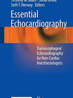 Essential Echocardiography: Transesophageal Echocardiography for Non-cardiac Anesthesiologists, ISBN-13: 978-3319341224