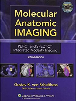 Molecular Anatomic Imaging: PET-CT and SPECT-CT Integrated Modality Imaging (2nd Edition)