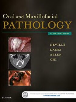 Oral and Maxillofacial Pathology (4th edition)