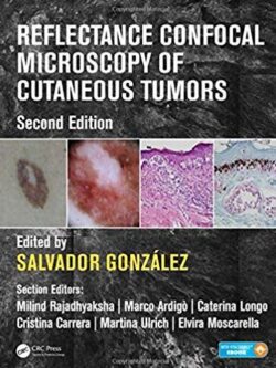 Reflectance Confocal Microscopy of Cutaneous Tumors 2nd Edition, ISBN-13: 978-1498757607