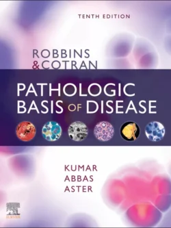 Robbins and Cotran Pathologic Basis of Disease (10th Edition)