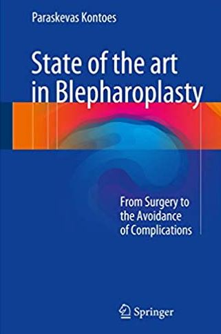 State of the art in Blepharoplasty: From Surgery to the Avoidance of Complications, ISBN-13: 978-3319526416 1 State of the art in Blepharoplasty: From Surgery to the Avoidance of Complications, ISBN-13: 978-3319526416