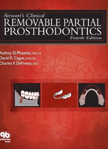 Stewart’s Clinical Removable Partial Prosthodontics 4th Edition Rodney D. Phoenix, ISBN-13: 978-0867154856 1 Stewart’s Clinical Removable Partial Prosthodontics 4th Edition Rodney D. Phoenix, ISBN-13: 978-0867154856