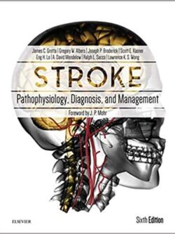 Stroke: Pathophysiology, Diagnosis, and Management (6th Edition)