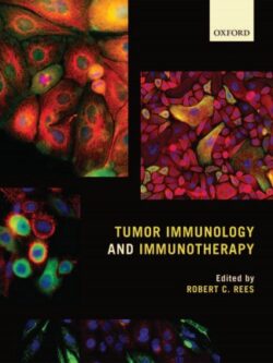 Tumor Immunology and Immunotherapy (Illustrated Edition)