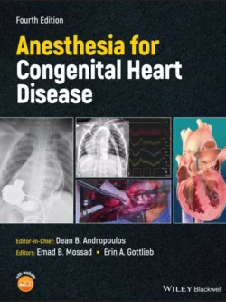 Anesthesia for Congenital Heart Disease (4th Edition)